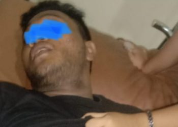 Pemuda di Medan Maimun Putus Jempol Demi Selamatkan Ibunya dari Serangan Kelewang